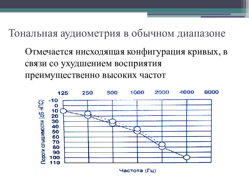 Сенсоневральная тугоухость картинки