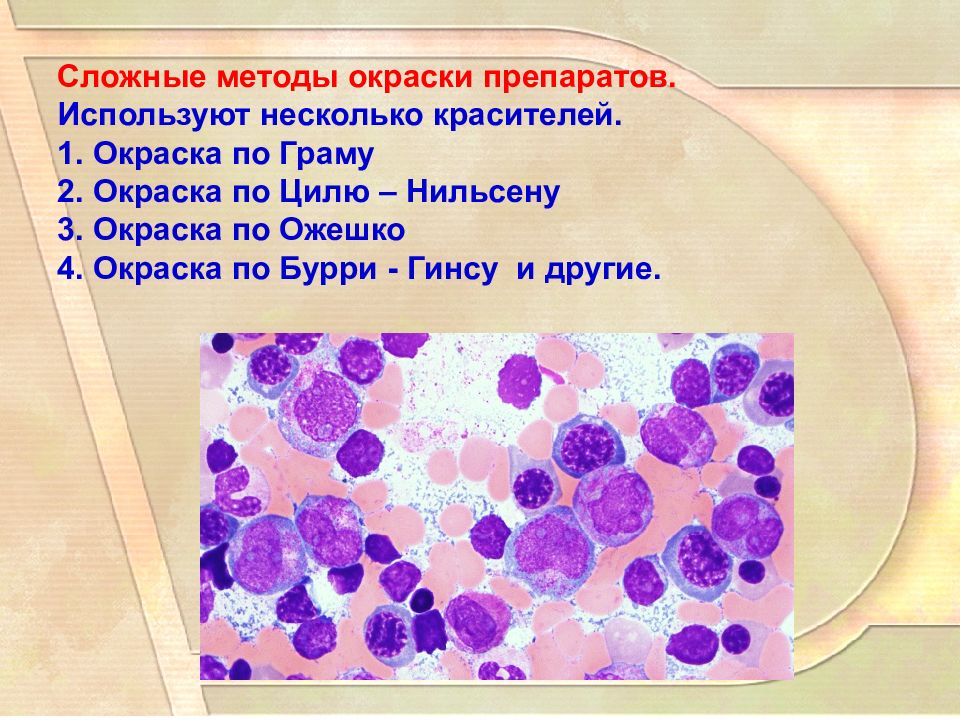 Граму циль. Сложные методы окраски препаратов. Микроскопический метод. Окраска по Граму и Цилю Нильсену сравнение. Окраска по Граму и Цилю Нильсену.