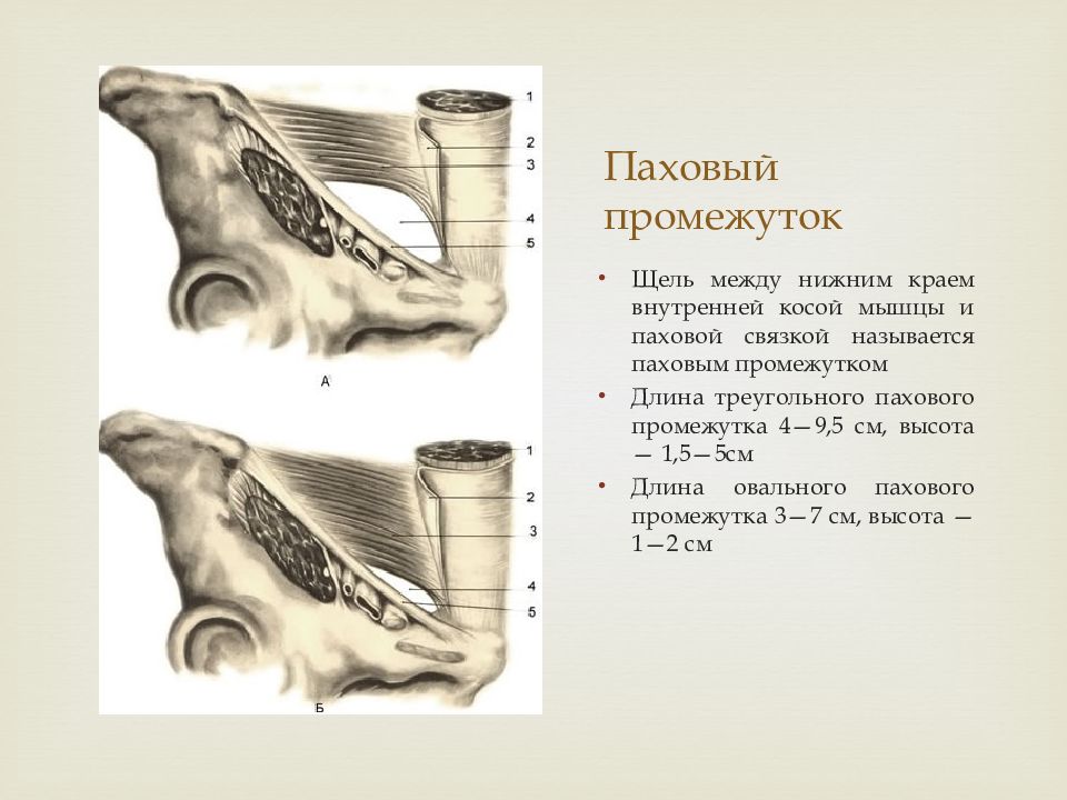 Стенки пахового треугольника