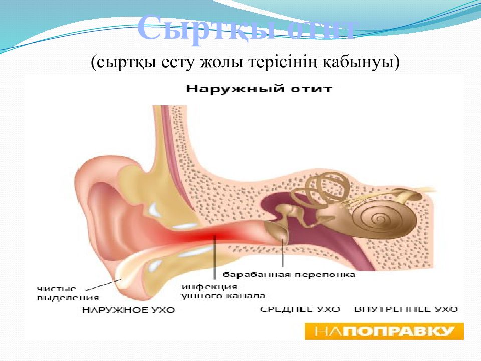 Отит код. Есту. Анатомическое объяснение отитов.