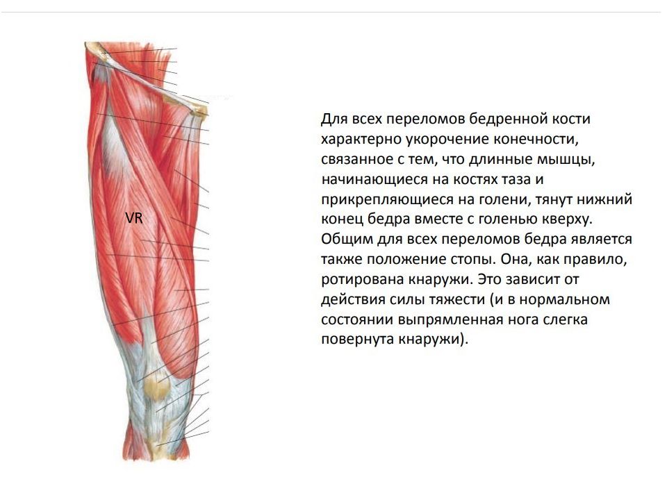 Топографическая анатомия нижней конечности презентация