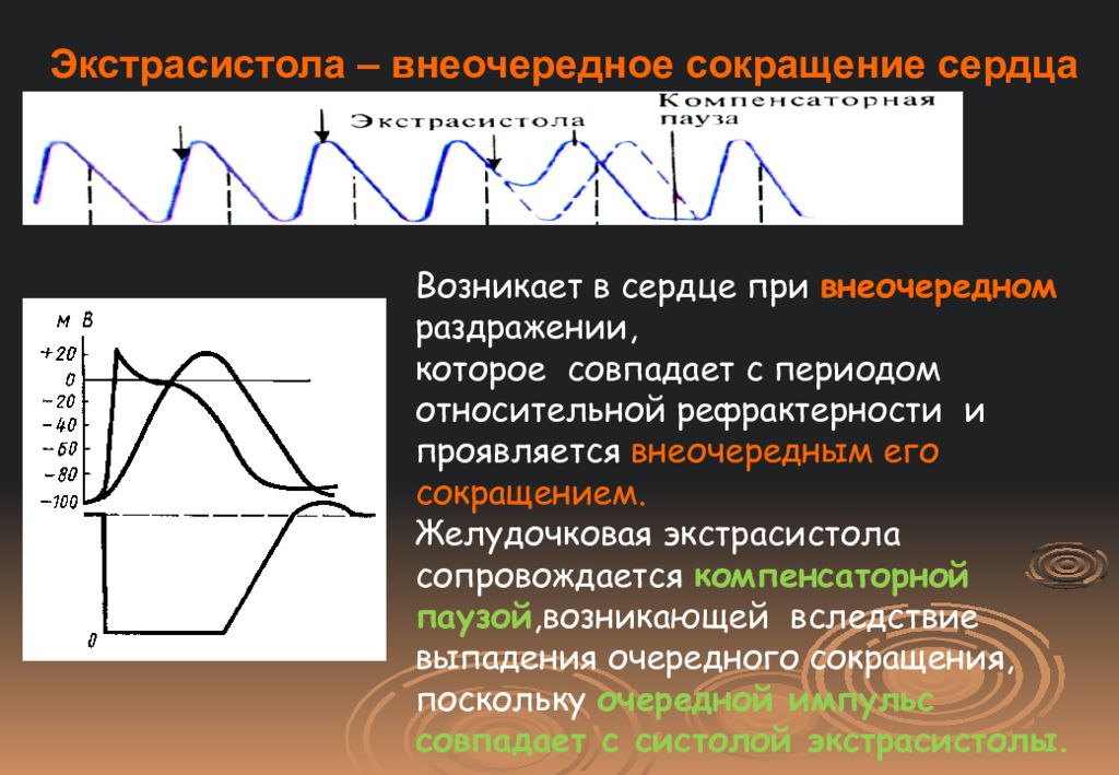 Период сердечного сокращения. Экстрасистола физиология график. Внеочередное сокращение сердца. Экстрасистолия – внеочередное сокращение сердца. Экстросистолафизиология.