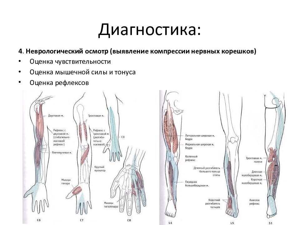 Дорсопатия неврология презентация