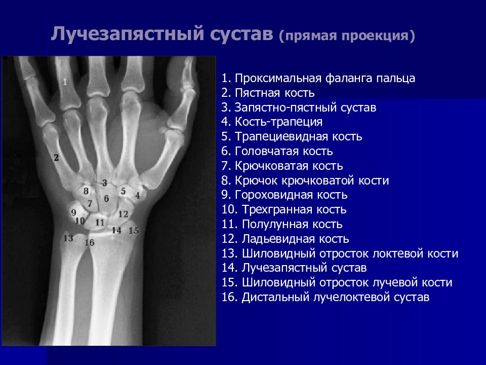 Лучезапястный сустав рентген анатомия картинки