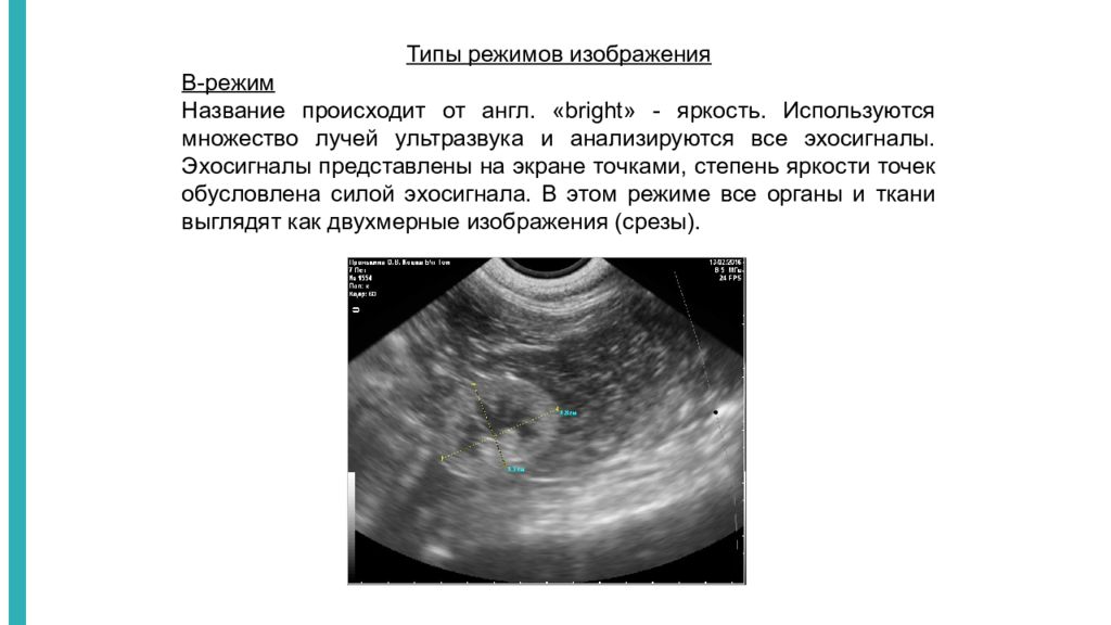 Режимы узи. Методики ультразвукового исследования a-режим. Режимы УЗИ исследования. Б режим ультразвукового исследования. Методики УЗИ режим а.