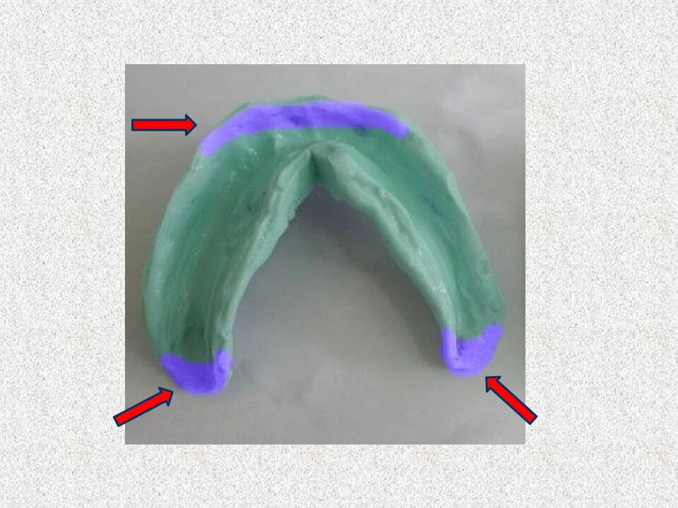 Funksional otisklar uchun individual qoshiqchalar