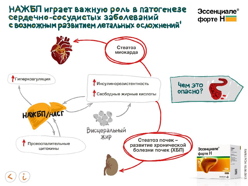 Презентация жировая болезнь печени