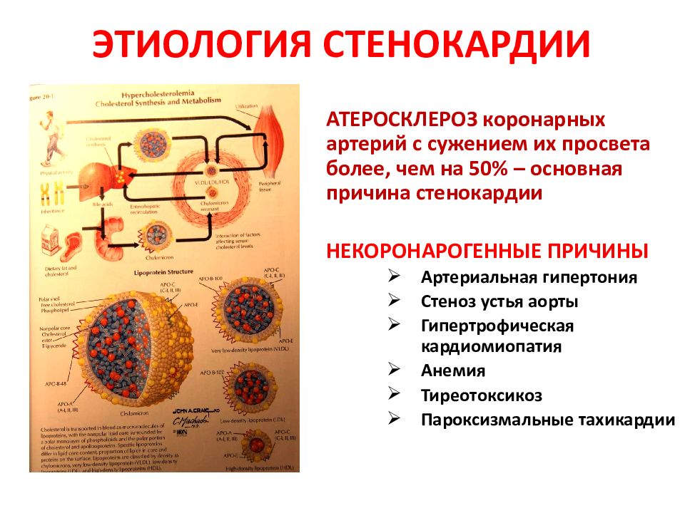 Ишемия презентация патофизиология