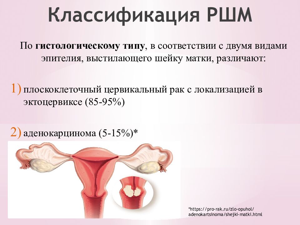 Рак шейки матки онкология презентация