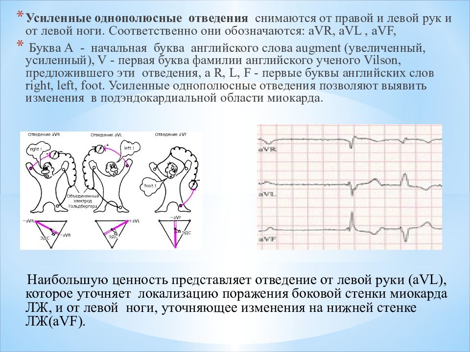 Картинка стандартные отведения