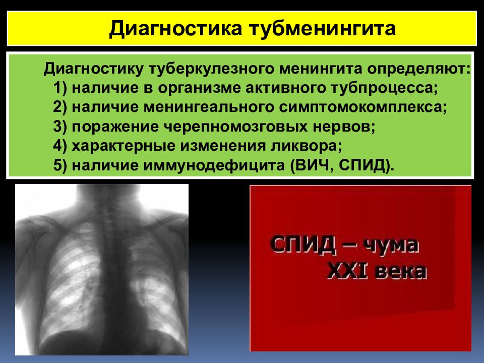 Пульмонология фтизиатрия. Туберкулезный менингит диагностика. Презентация на тему туберкулезный менингит. Золотой стандарт диагностики туберкулезного менингита. Фтизиатрия и пульмонология.