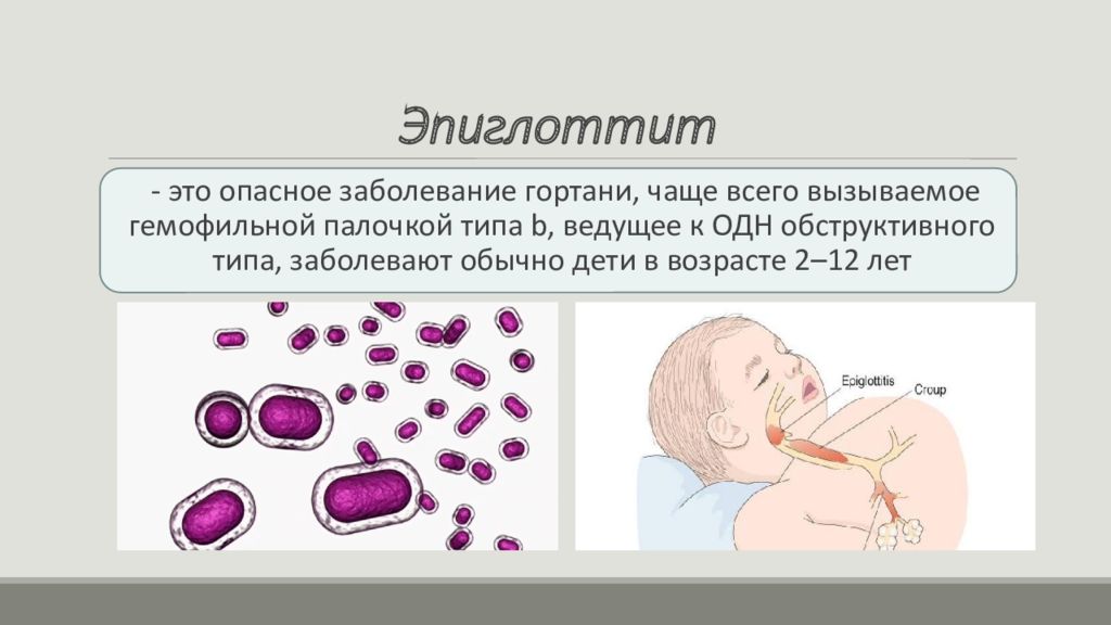 Острая дыхательная недостаточность у детей презентация