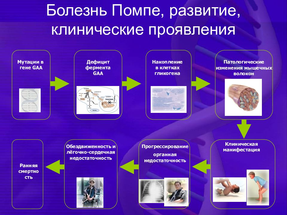 Болезнь помпе презентация