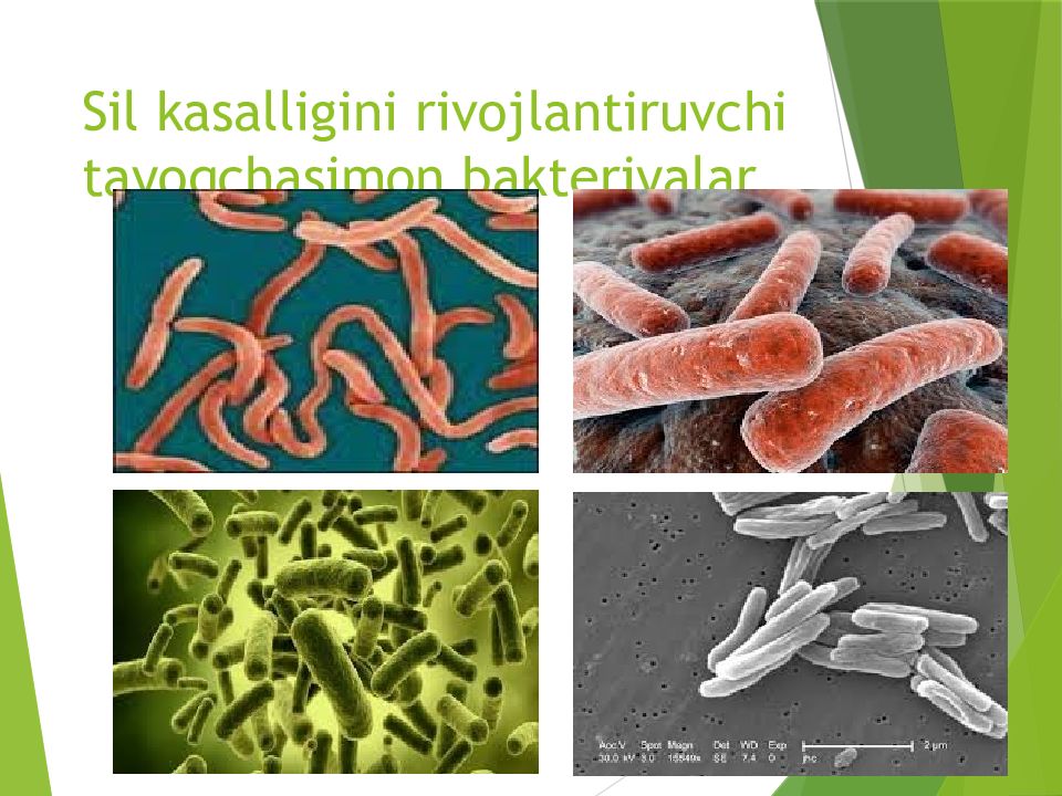 O'PKA OBSTRUKTIV YETISHMOVCHILIGI DIAGNOSTIKASI Sil kasalligini rivojlantiruvchi tayoqchasimon bakteriyalar