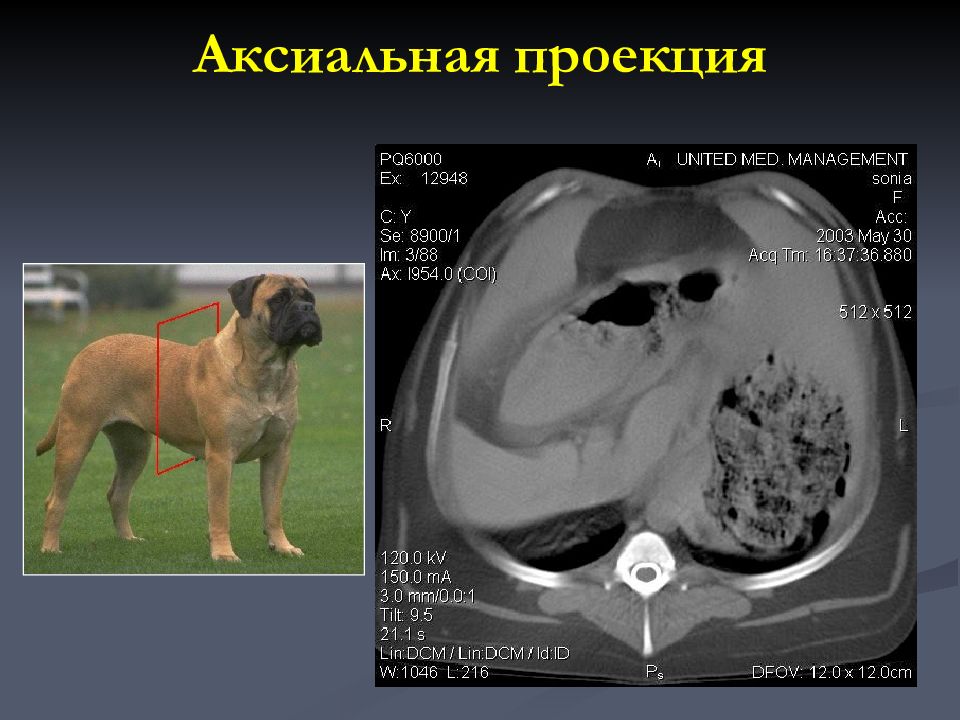 Аксиальная проекция. Аксиальная проекция кт. Аксиальная проекция рентген. Аксиальная и коронарная проекции.