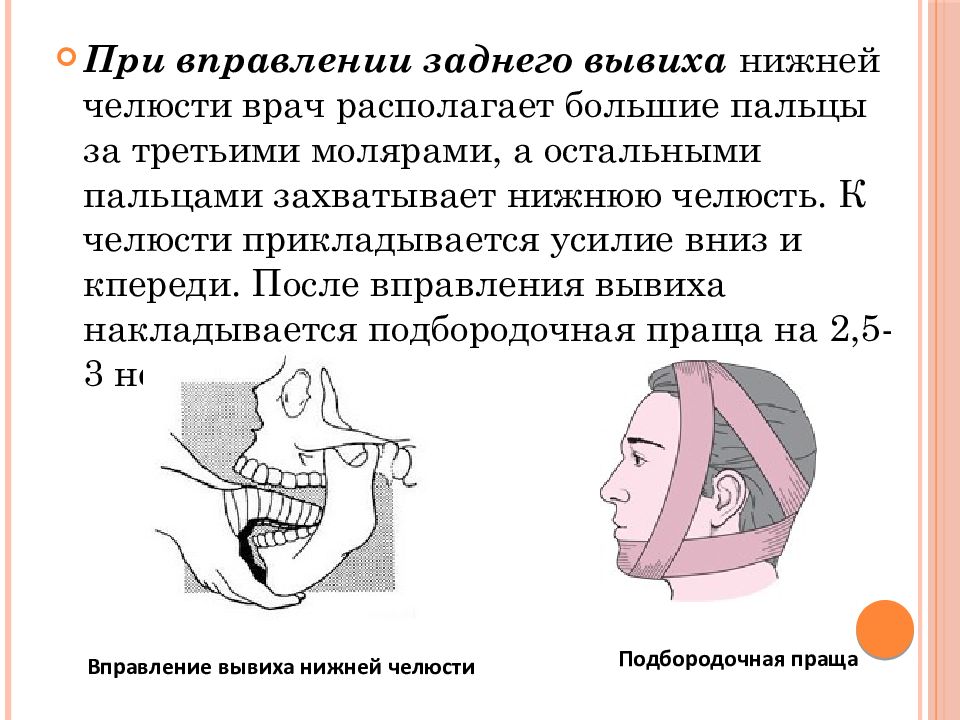 Не открывается челюсть после. Методика вправления вывиха нижней челюсти. Вправление переднего вывиха нижней челюсти. Передний односторонний вывих нижней челюсти.