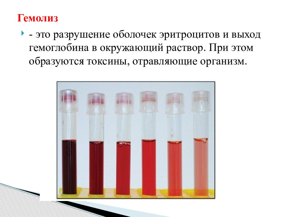 Гемолиз эритроцитов. Гемолиз. Шкала гемолиза.