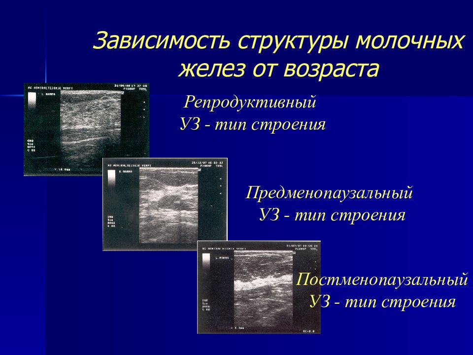 Железистый тип строения молочных желез