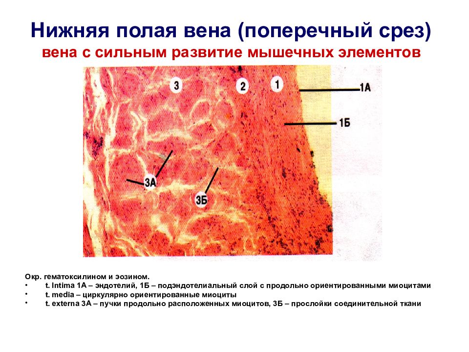 Стенка артериовенозного анастомоза не содержит гладких миоцитов