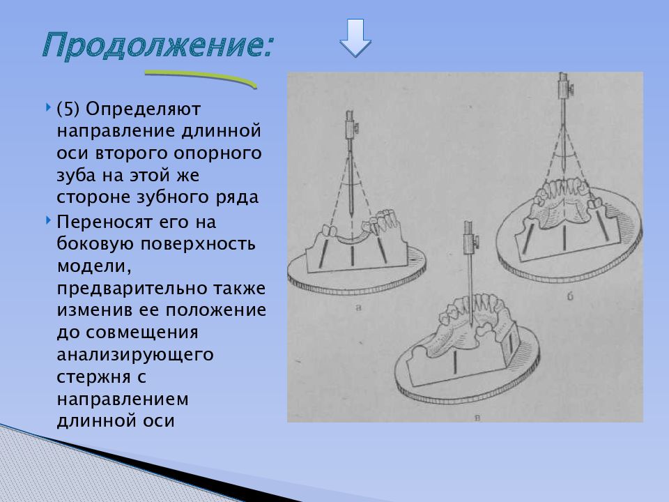 Презентация на тему параллелометрия