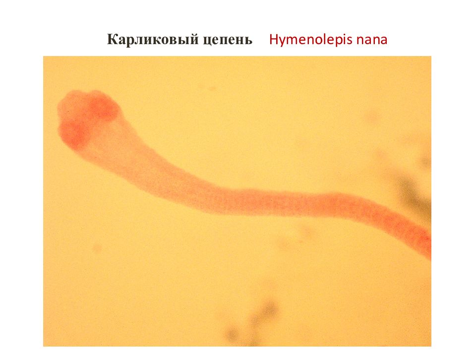 Карликовый цепень. Карликовый цепень (Hymenolepis Nana). Карликовый цепень микроскоп. Карликовый цепень - Hymenolepis Nana строение. Карликовый цепень микропрепарат.