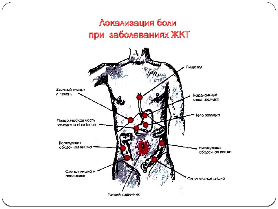 Локализация боли. Локализация болей при заболеваниях печени. Локализация боли при заболеваниях тонкого кишечника. Карта локализации боли.