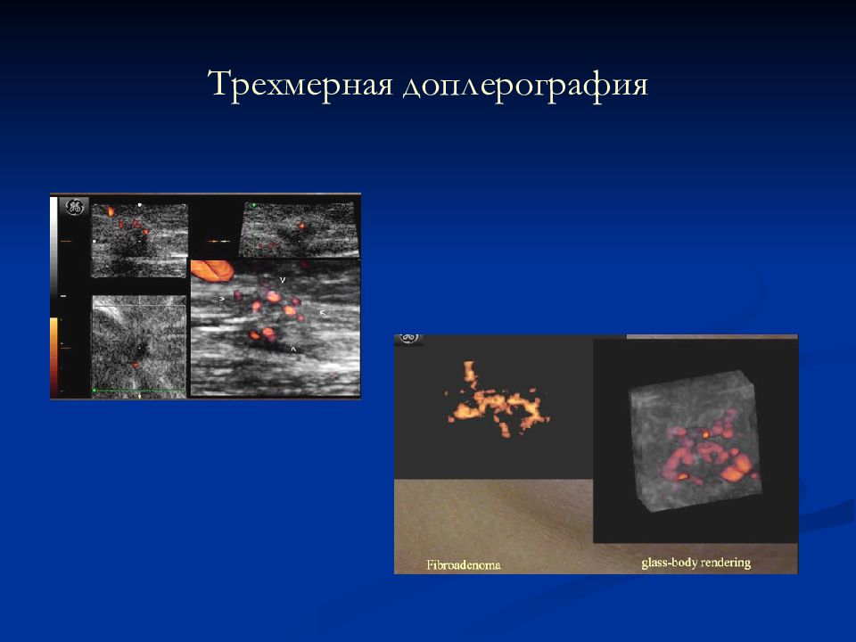 Лучевая диагностика заболеваний молочных желез презентация