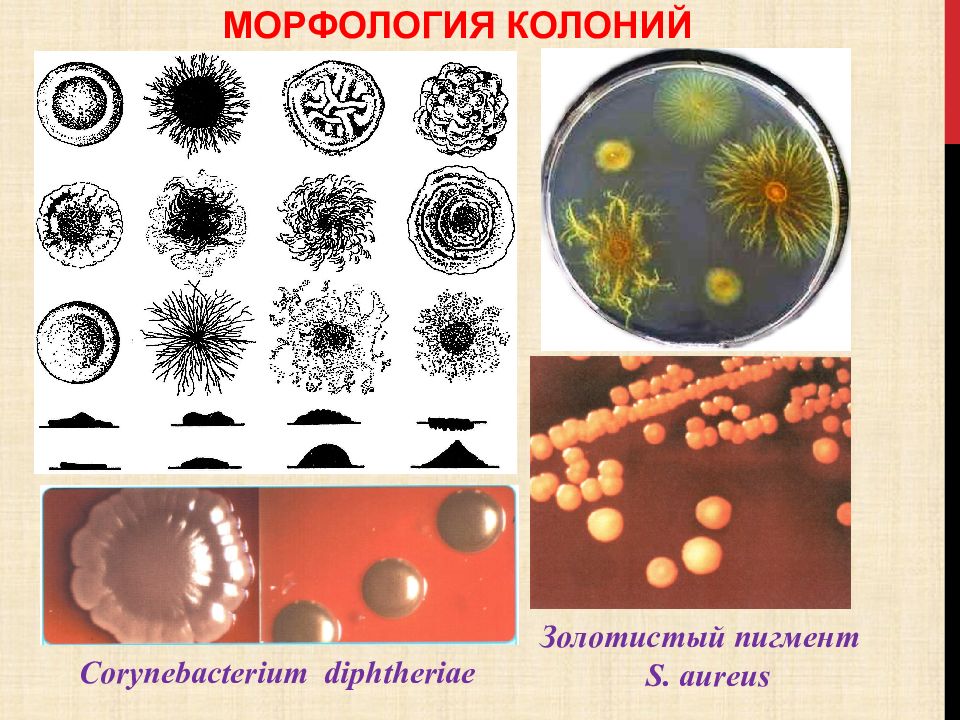 Колония это микробиология. Морфология бактериальных колоний. Формы колоний бактерий. Морфология колоний микроорганизмов. Формы колоний микробиология.