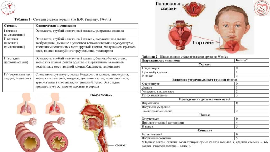 Заболевание верхнего. Заболевания верхних дыхательных путей у детей. Детские болезни верхних дыхательных путей. Острые заболевания верхних дыхательных путей у детей. Болезни верхних дых путей у детей.