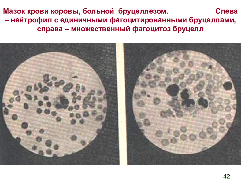 Возбудитель бруцеллеза картинка