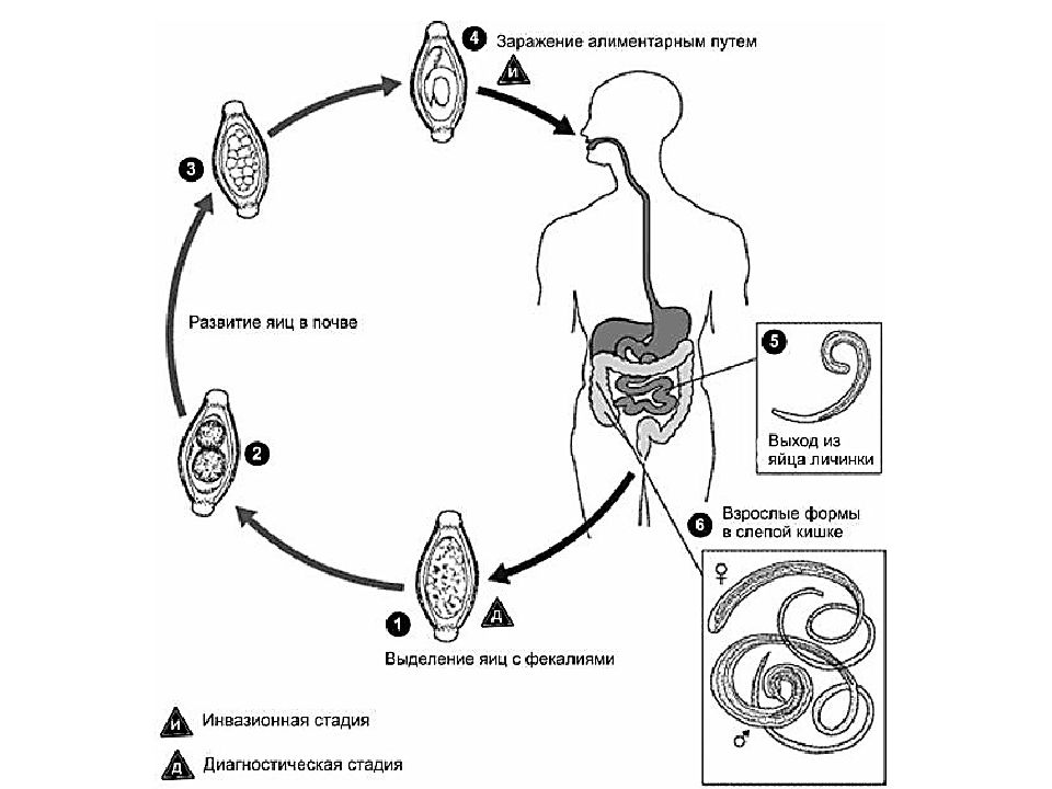 Человеческий жизненный цикл. Власоглав Trichocephalus Trichiurus жизненный цикл. Жизненный цикл власоглава схема. Власоглав человеческий жизненный цикл. Власоглав человеческий жизненный цикл схема.