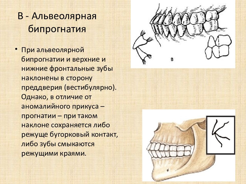 Биомеханика нижней челюсти