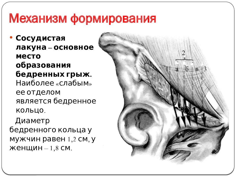 Сосудистая лакуна