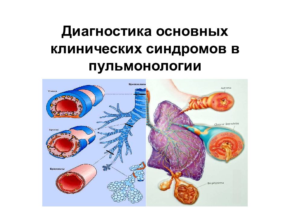 Диагностика основных клинических синдромов в пульмонологии