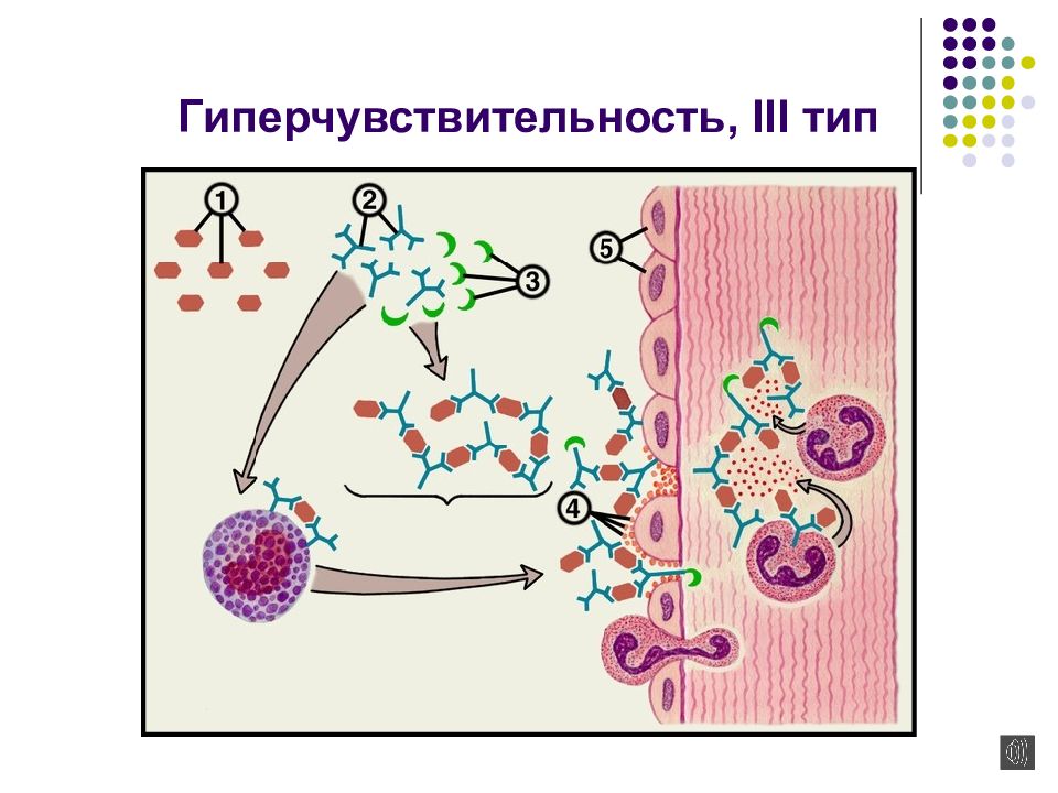 Типы гиперчувствительности. Третий Тип гиперчувствительности. Реакция гиперчувствительности 3 типа механизм. Гиперчувствительность 2 типа иммунология схема. Схема реакции гиперчувствительности 3 типа.