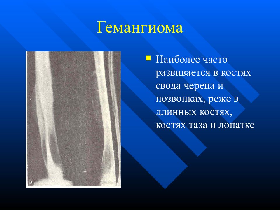 Опухоли опухолеподобные поражения и кисты кожи лица презентация