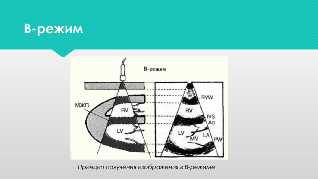 B режим. Режим изображения. Принцип получения фотографии. B-режим изображения (. Принцип получения ультразвукового изображения в в-режими и м-режиме.