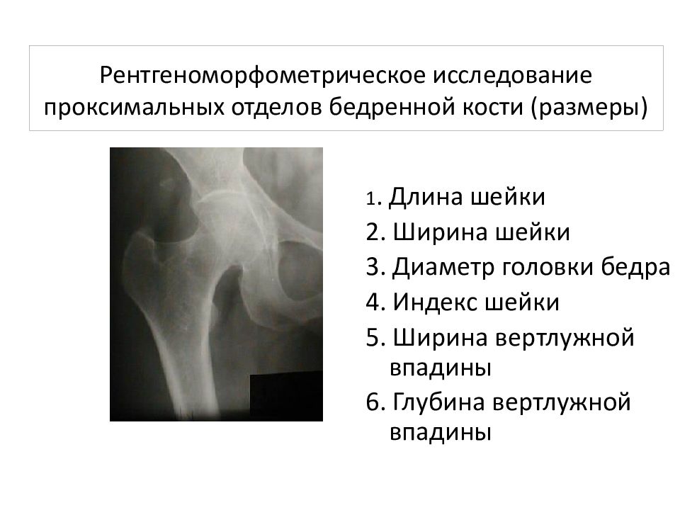 Отделы вертлужной впадины. Крыша вертлужной впадины. Угол вертикального наклона вертлужной впадины. Угол наклона вертлужной впадины.