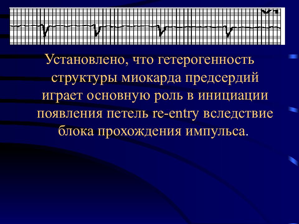 Поставь импульсы. Теория гетерогенности миокарда. Пространственная гетерогенность миокарда. Фибрилляция предсердий импульсы. Выраженная пространственная гетерогенность миокарда.