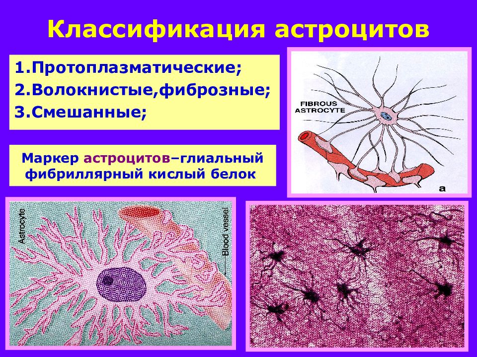 Астроциты. Протоплазматические астроциты гистология. Протоплазматические астроциты функции. Плазматические астроциты строение. Волокнистые астроциты функции.