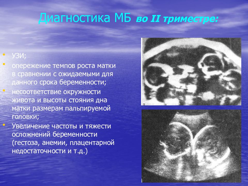 Многоплодная беременность. Презентация на тему многоплодная беременность. Диагностика многоплодной беременности. Течение многоплодной беременности.