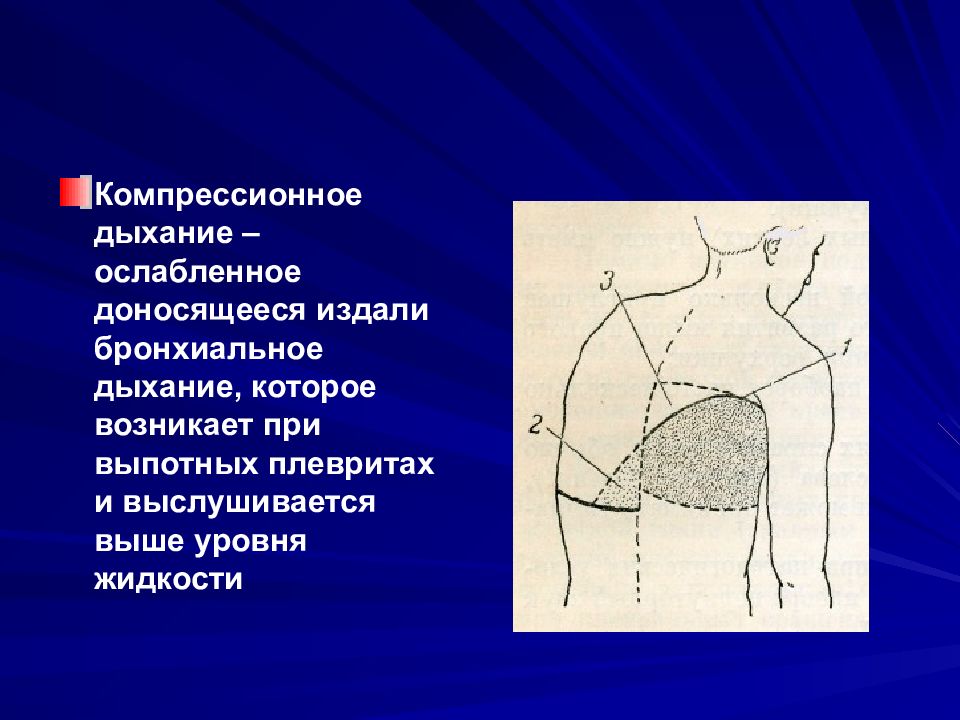 Ослабленное дыхание. Бронхиальное дыхание пропедевтика внутренних болезней. Компрессионное бронхиальное дыхание. Компрессионный вариант патологического бронхиального дыхания. Патологическое бронхиальное дыхание.