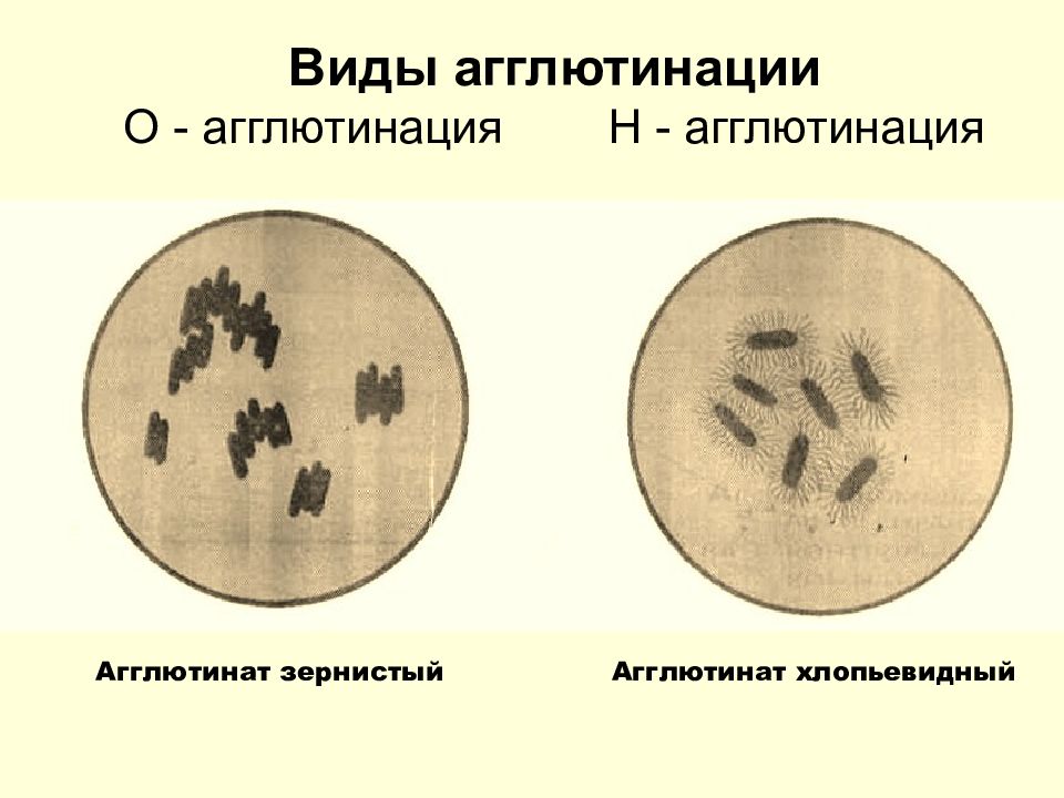 Вид n. Виды агглютинации. Агглютинация бактерий. Что такое о и н агглютинация. Реакция агглютинации виды.