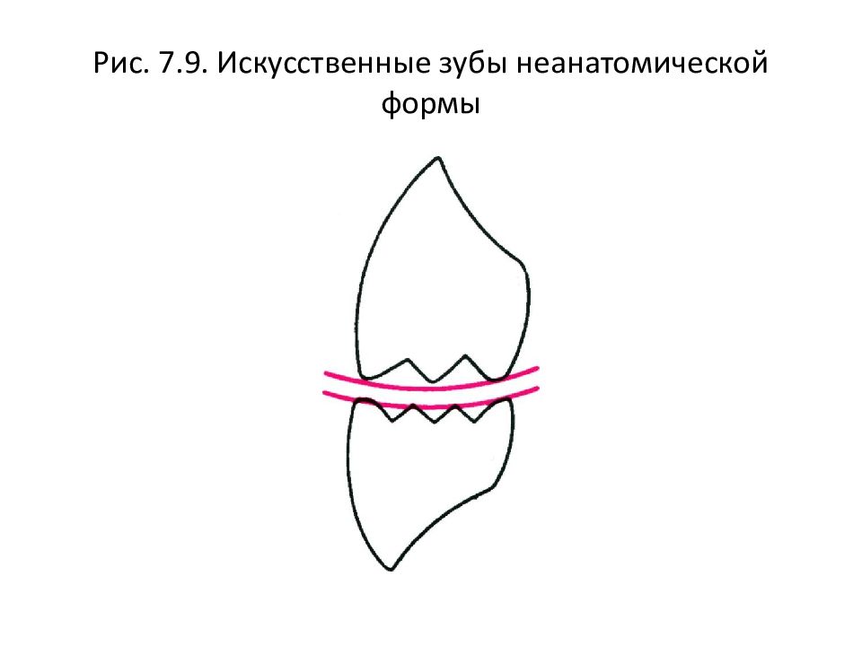 Искусственные зубы презентация