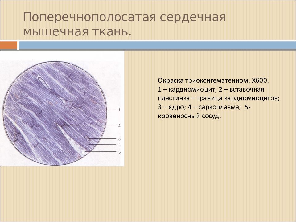 Сердечная ткань. Поперечнополосатая сердечная мышечная ткань. Поперечная сердечная мышечная ткань гистология. Поперечнополосатая сердечная мышечная ткань гистология. Поперечная полосатая сердечная мышечная ткань.