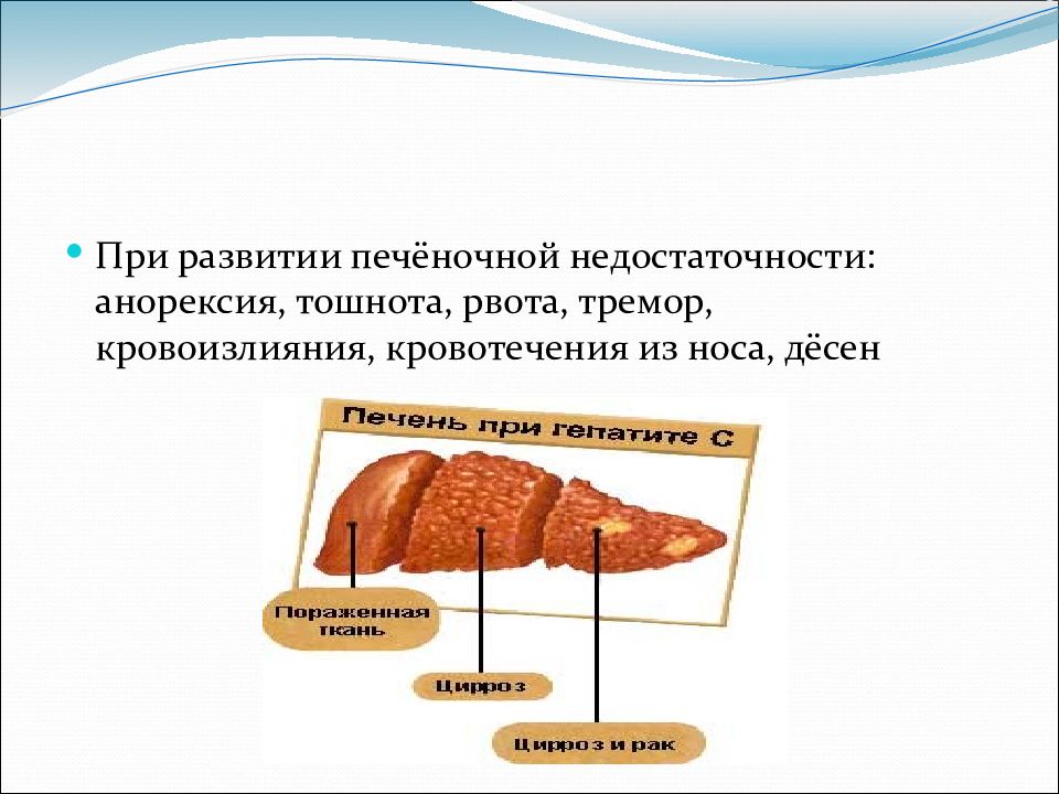 Развитие печени. Рвота при печеночной недостаточности. Источником развития печени являются. Вирусный гепатит с печеночная недостаточность.