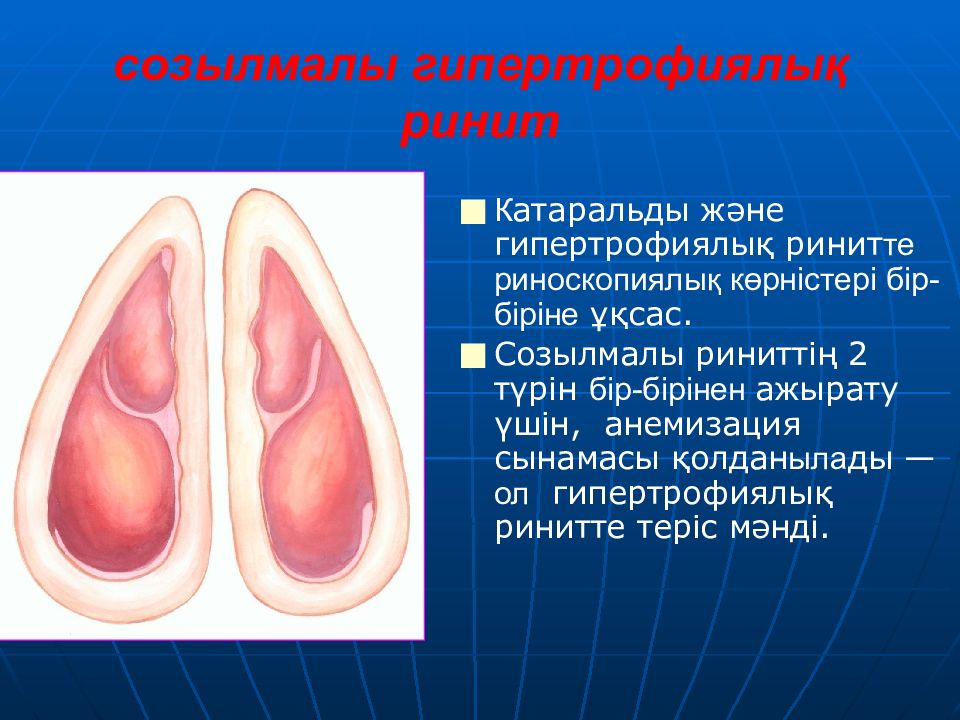 Субатрофический ринит