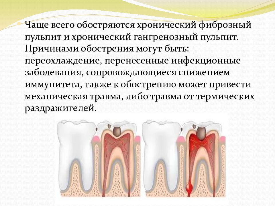 Медицинская карта стоматологического больного хронический фиброзный пульпит