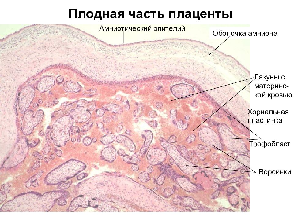 Плацента гистология. Хориальная пластинка гистология. Плодная часть плаценты человека представлена.