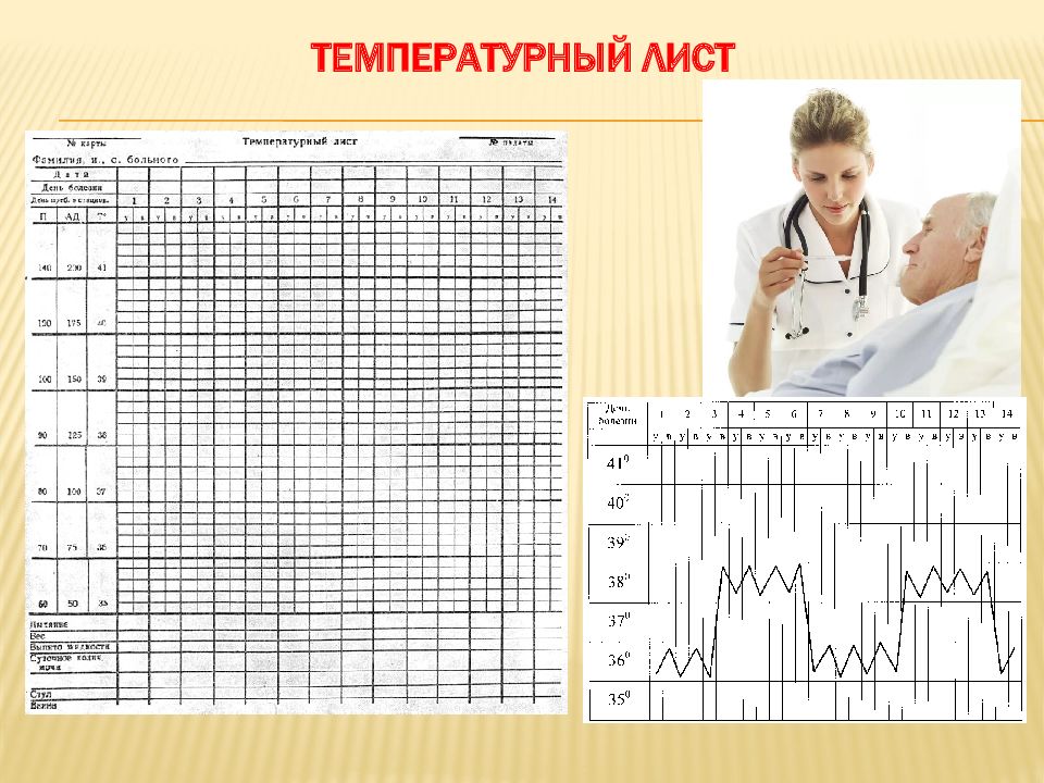 Как отметить пульс на температурном листе образец